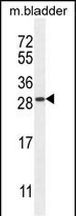 TIFAB Antibody in Western Blot (WB)