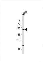 SLC16A11 Antibody in Western Blot (WB)