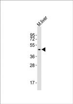 SLC16A11 Antibody in Western Blot (WB)