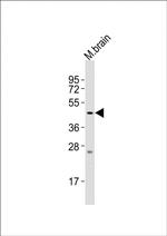 SLC16A11 Antibody in Western Blot (WB)