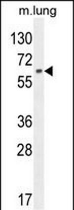 NFE2L1 Antibody in Western Blot (WB)