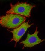 Complement Factor H Antibody in Immunocytochemistry (ICC/IF)