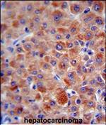 Complement Factor H Antibody in Immunohistochemistry (Paraffin) (IHC (P))