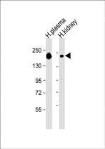 Complement Factor H Antibody in Western Blot (WB)