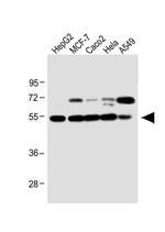 Apolipoprotein J Antibody in Western Blot (WB)