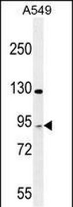 TAGAP Antibody in Western Blot (WB)