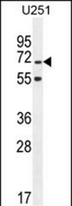 TNIP1 Antibody in Western Blot (WB)