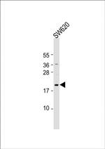 NUDT15 Antibody in Western Blot (WB)