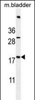 SDHAF3 Antibody in Western Blot (WB)