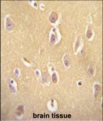 OR13J1 Antibody in Immunohistochemistry (Paraffin) (IHC (P))