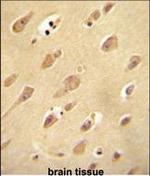 OR5L2 Antibody in Immunohistochemistry (Paraffin) (IHC (P))