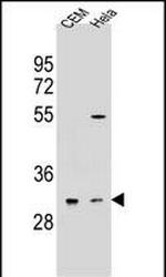 OR5L2 Antibody in Western Blot (WB)