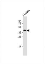 GFRAL Antibody in Western Blot (WB)