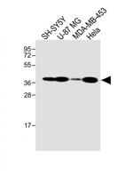 GFRAL Antibody in Western Blot (WB)