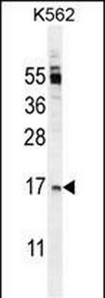 OX40L Antibody in Western Blot (WB)