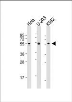 AIRE Antibody in Western Blot (WB)