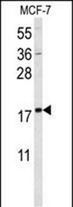 SUMO1 Antibody in Western Blot (WB)