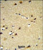 CYP26A1 Antibody in Immunohistochemistry (Paraffin) (IHC (P))