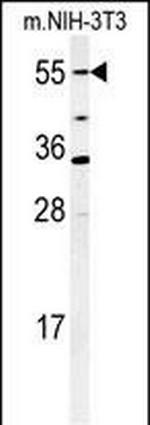 CYP26A1 Antibody in Western Blot (WB)