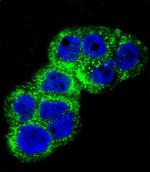 IGF1R alpha Antibody in Immunocytochemistry (ICC/IF)