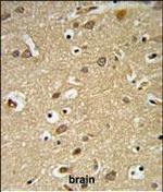 IGF1R alpha Antibody in Immunohistochemistry (Paraffin) (IHC (P))