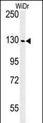 IGF1R alpha Antibody in Western Blot (WB)