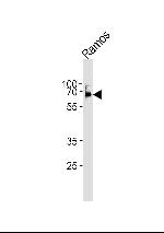 LCK Antibody in Western Blot (WB)