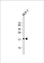 Cofilin Antibody in Western Blot (WB)