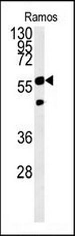 PHGDH Antibody in Western Blot (WB)