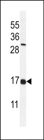 IFITM2 Antibody in Western Blot (WB)