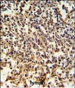 RNaseH2B Antibody in Immunohistochemistry (Paraffin) (IHC (P))