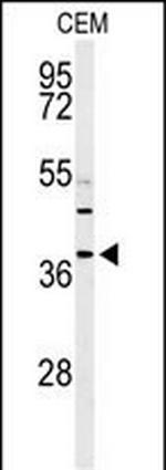 RNaseH2B Antibody in Western Blot (WB)