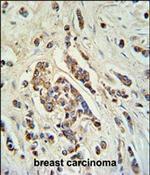 ABCC11 Antibody in Immunohistochemistry (Paraffin) (IHC (P))