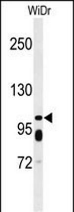 ABCC11 Antibody in Western Blot (WB)