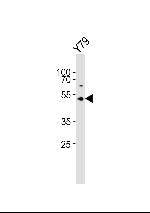 ASMT Antibody in Western Blot (WB)