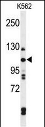 TELO2 Antibody in Western Blot (WB)