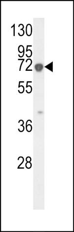 KRT9 Antibody in Western Blot (WB)