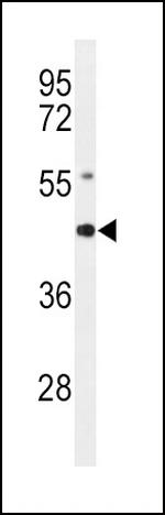 RAGE Antibody in Western Blot (WB)