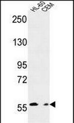 MICALL2 Antibody in Western Blot (WB)