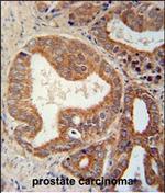 CSGALNACT1 Antibody in Immunohistochemistry (Paraffin) (IHC (P))