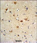 CD64 Antibody in Immunohistochemistry (Paraffin) (IHC (P))