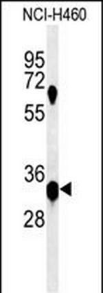 KCTD1 Antibody in Western Blot (WB)