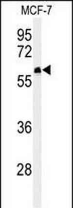 FAM20A Antibody in Western Blot (WB)