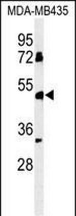 BTNL8 Antibody in Western Blot (WB)