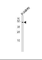 PSMAL Antibody in Western Blot (WB)