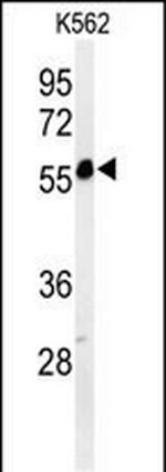 PSMAL Antibody in Western Blot (WB)