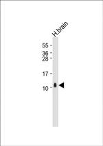 S100B Antibody in Western Blot (WB)