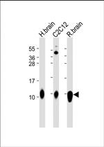 S100B Antibody in Western Blot (WB)