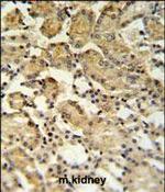 XBP1 Antibody in Immunohistochemistry (Paraffin) (IHC (P))