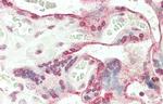 JHDM1D Antibody in Immunohistochemistry (Paraffin) (IHC (P))